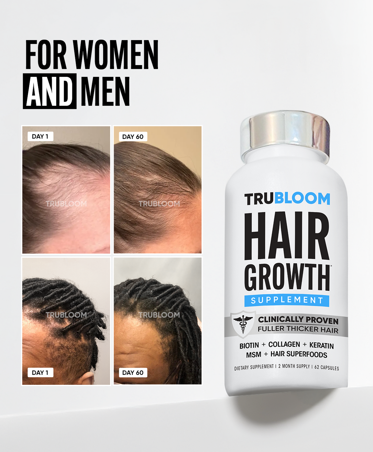 TRU BLOOM Hair Growth Vitamins