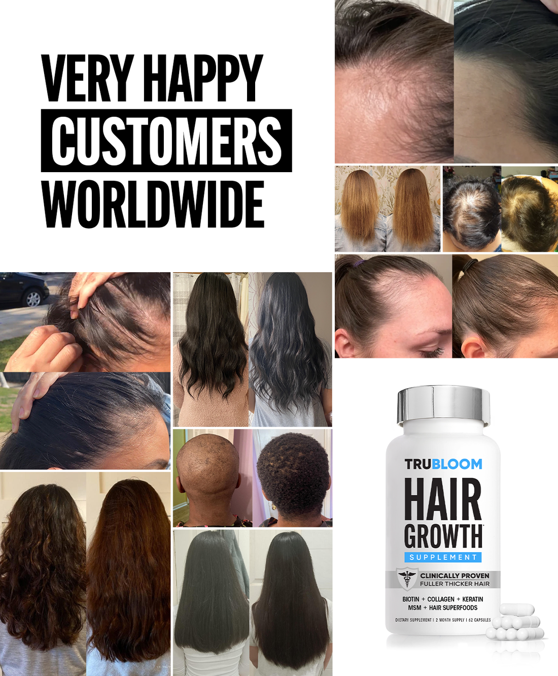 TRU BLOOM Hair Growth Vitamins - 60 Day Hair Challenge ( 2 Month Supply )