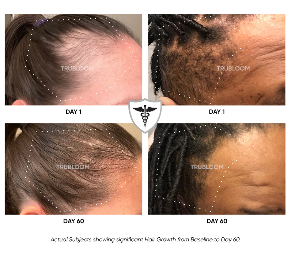 Hair Growth Supplement Bottles