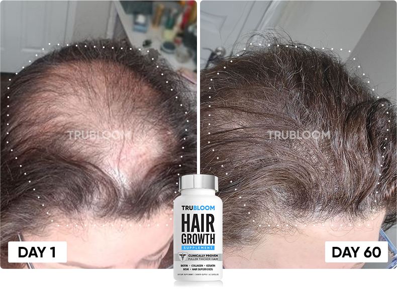 TRU BLOOM customer before and after
