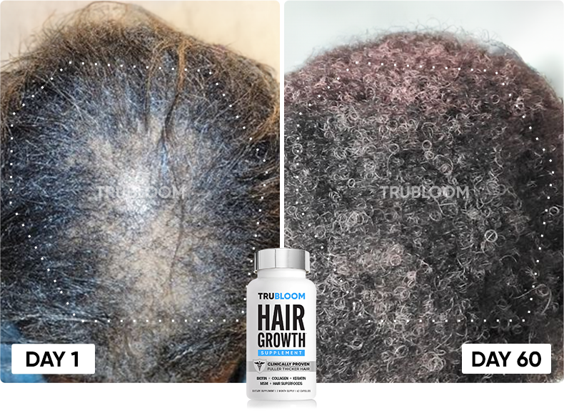 TRU BLOOM customer before and after