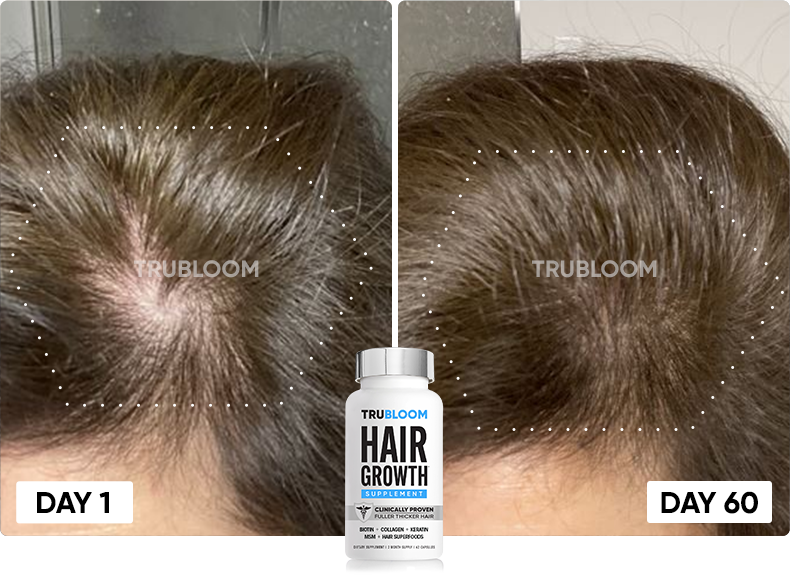 TRU BLOOM customer before and after