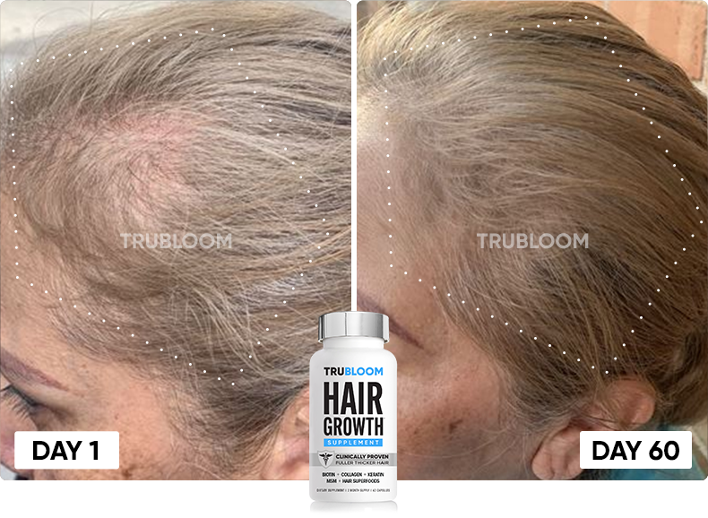 TRU BLOOM customer before and after