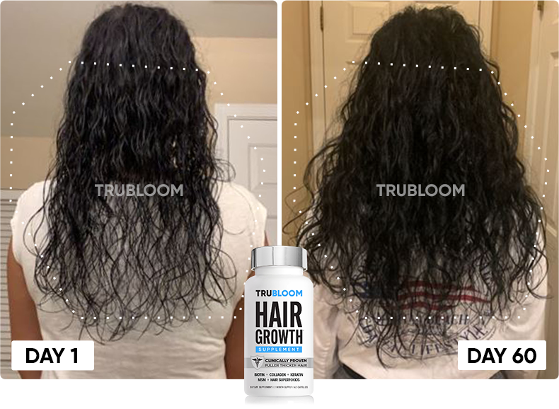 TRU BLOOM customer before and after