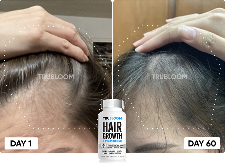 TRU BLOOM customer before and after