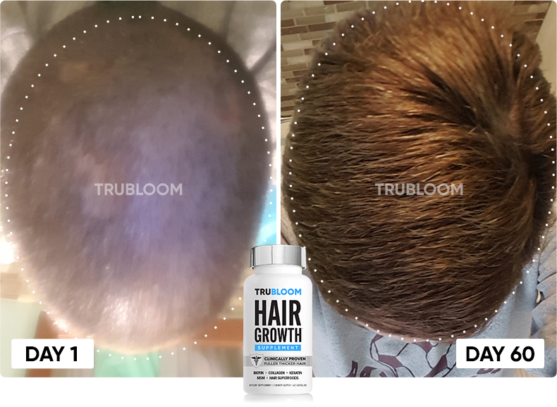 TRU BLOOM customer before and after