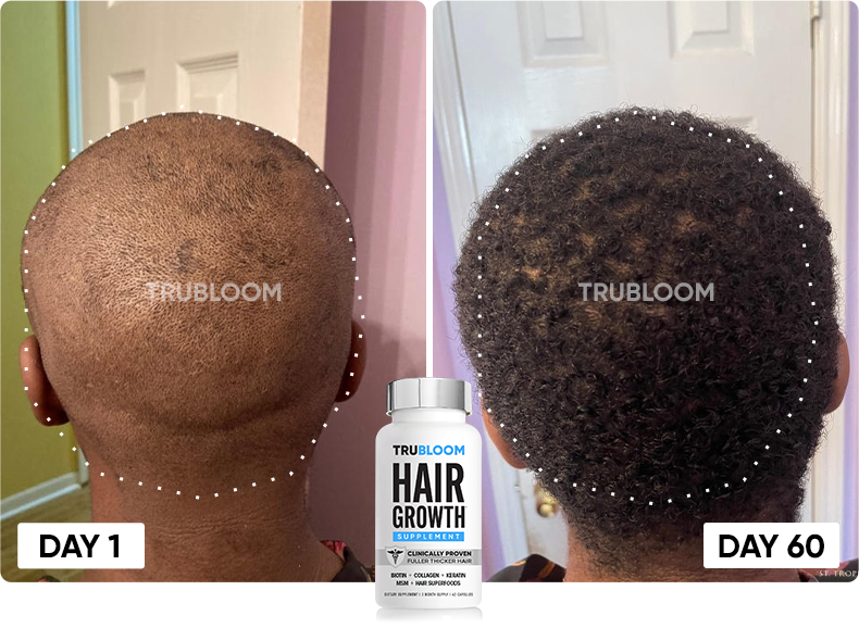 TRU BLOOM customer before and after