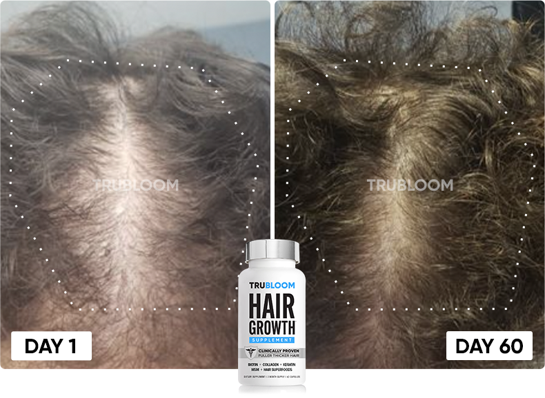 TRU BLOOM customer before and after